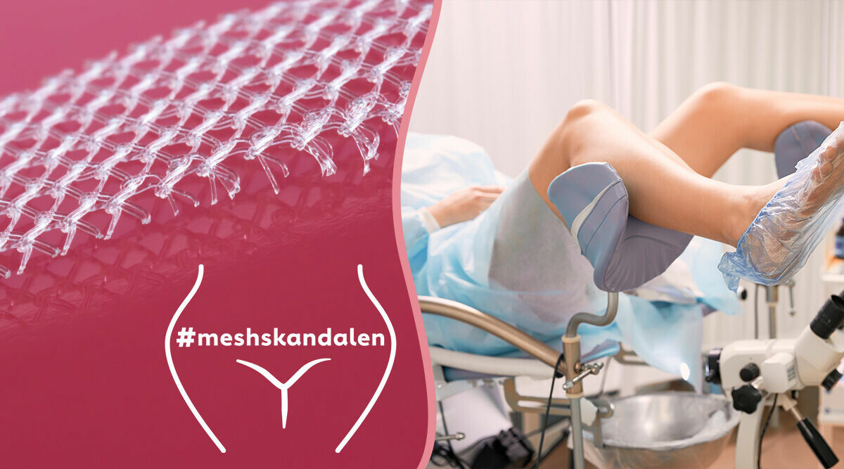 Mesh-skandalen: Tusentals kvinnor skadade av sina inkontinensnät