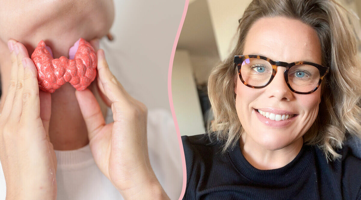 Kim har Hashimotos sjukdom: "Gjorde stora livsstilsförändringar"