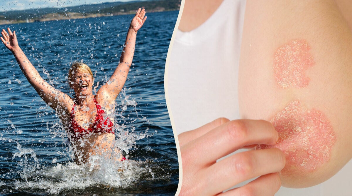 Hudforskaren om salta bad: Kan lindra många hudproblem