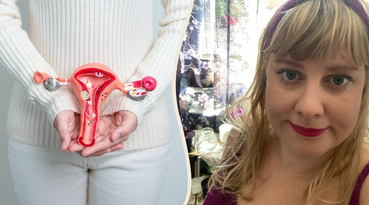 Erica opererades för endometrios i England: "Mina föräldrar tog lån"