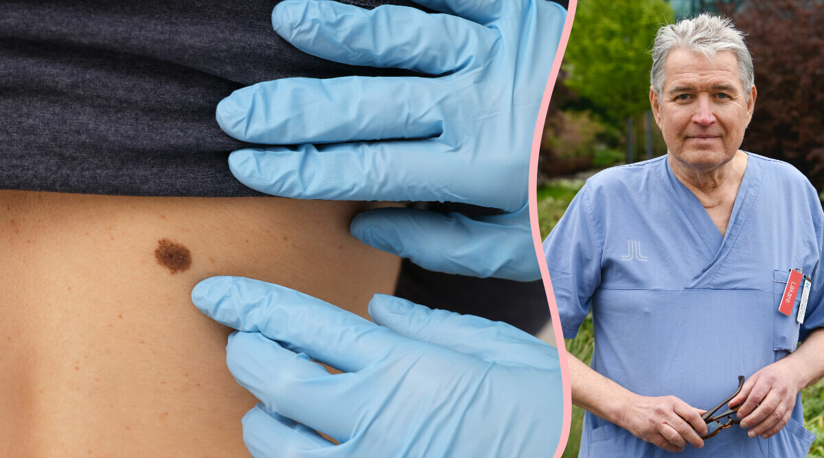 Så vet du om hudförändringen är farlig: "Måste behandlas i tid"