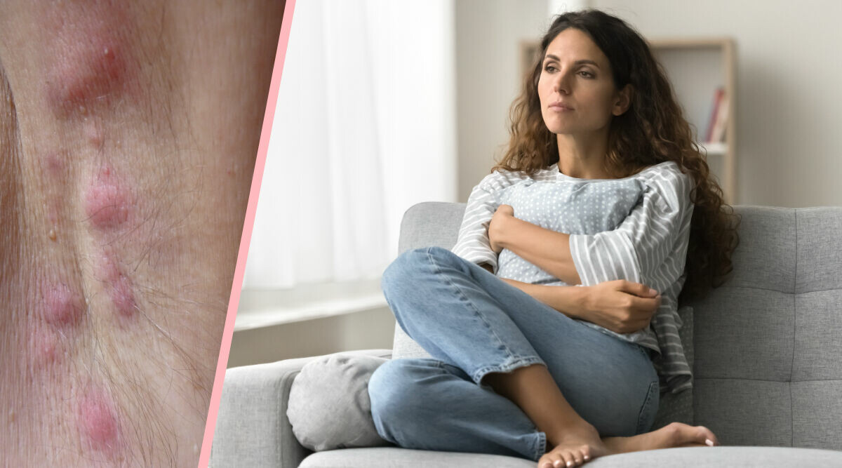 Smärtande bölder? Då kan det vara svårställda diagnosen