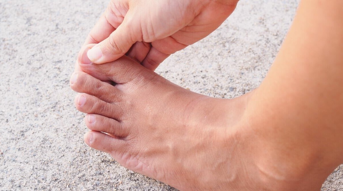 Experten tipsar: Så blir du av med nagelsvamp