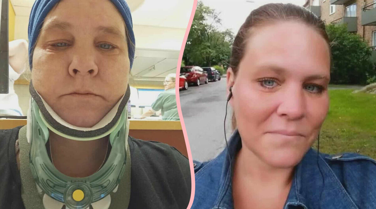 Malin svimmade i trappan – gick tre dagar med bruten nacke