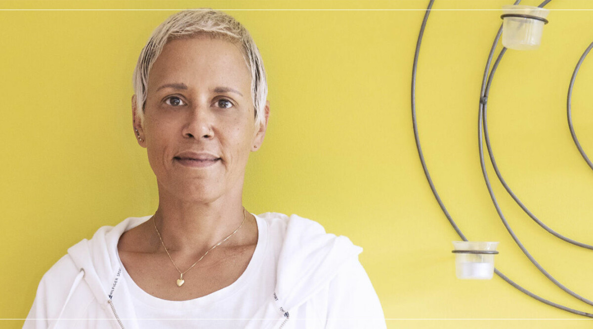 Kim gjorde hårtransplantation efter kampen mot bröstcancer