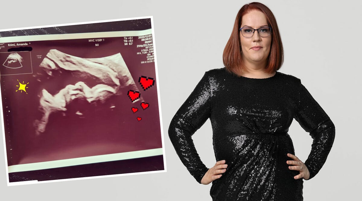 Amanda Krimi från Biggest loser: "Vi väntar barn!"