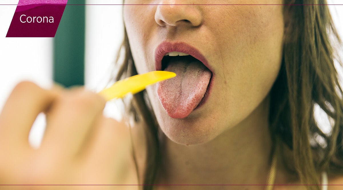 Covid-tunga kan vara ett tidigt tecken på coronasmitta