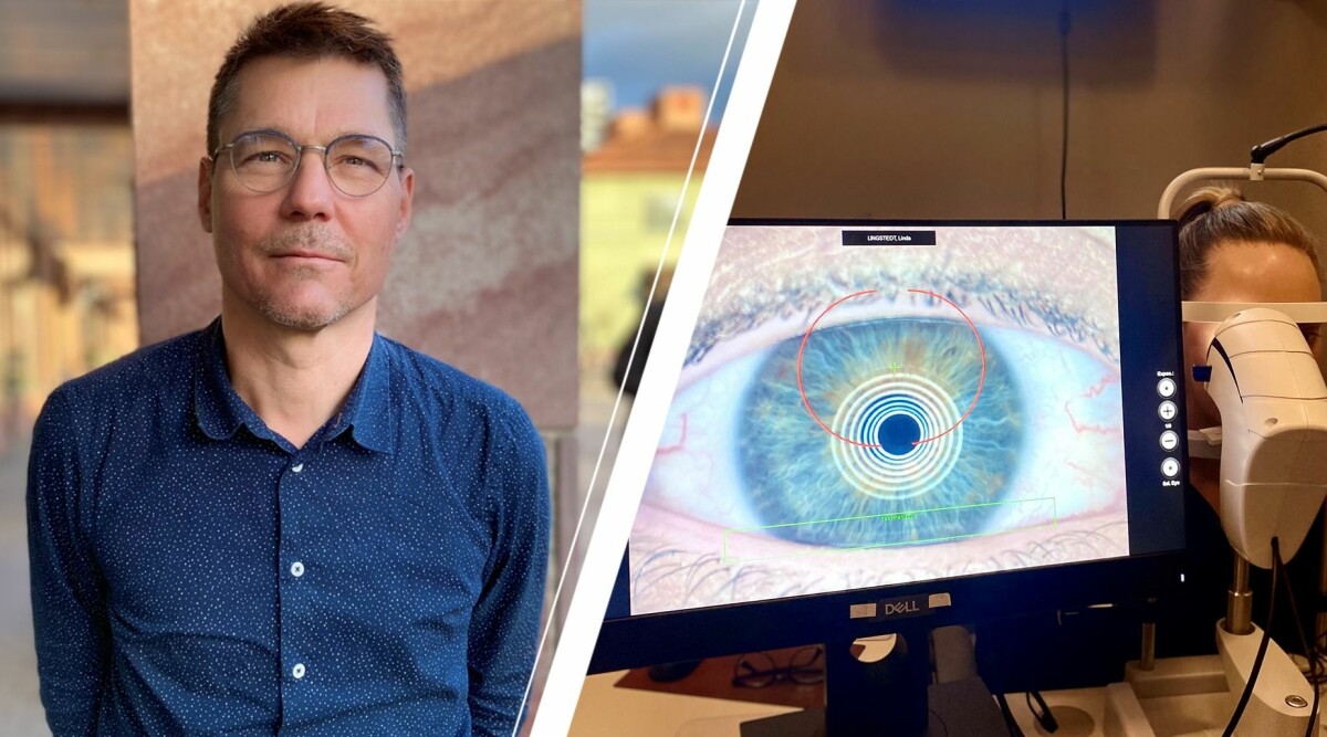 Optikern om ”klimakterie-ögon” – många lider av döda körtlar i ögonen