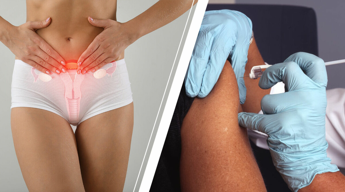 Vanliga cancerformen kan utrotas helt – med hjälp av vaccin