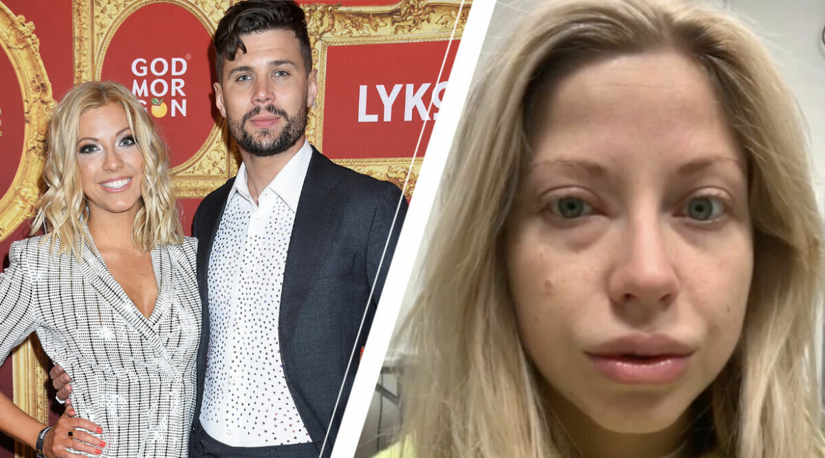 Sigrid Bernson om utbrändheten: ”Väckte Robin och sa – nu dör jag”