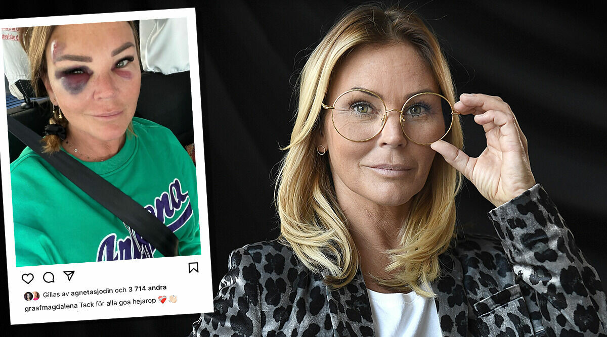 Magdalena Graafs otäcka olycka – fick biverkning av sin hjärtmedicin