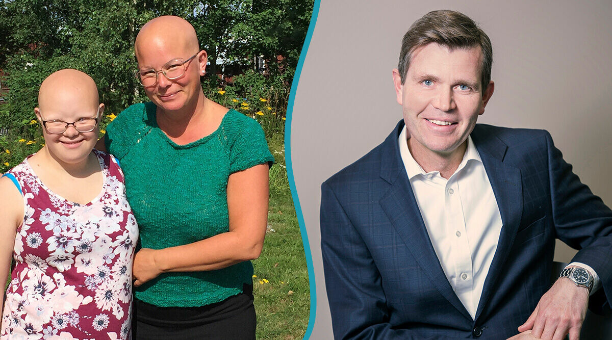 Linda har alopecia universalis: ”Varit helt hårlös i fyra år"