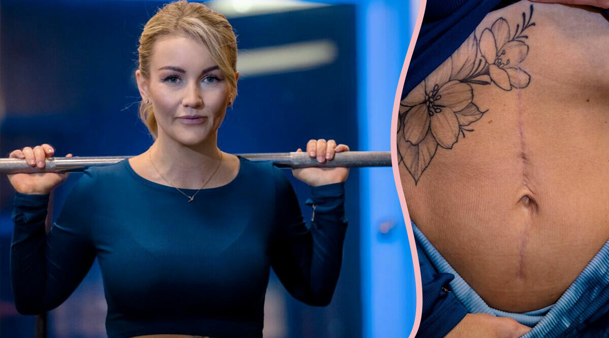 Nathalie sökte vård för ett bråck: ”Tumören hittades av en slump”
