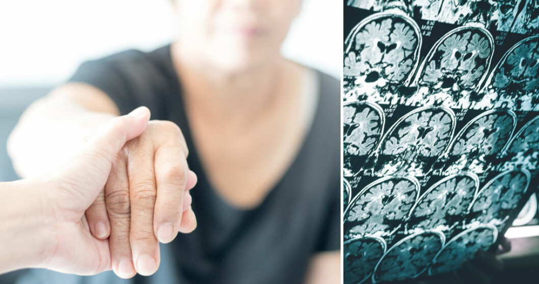 Ny metod ska hitta alzheimers sjukdom snabbare.