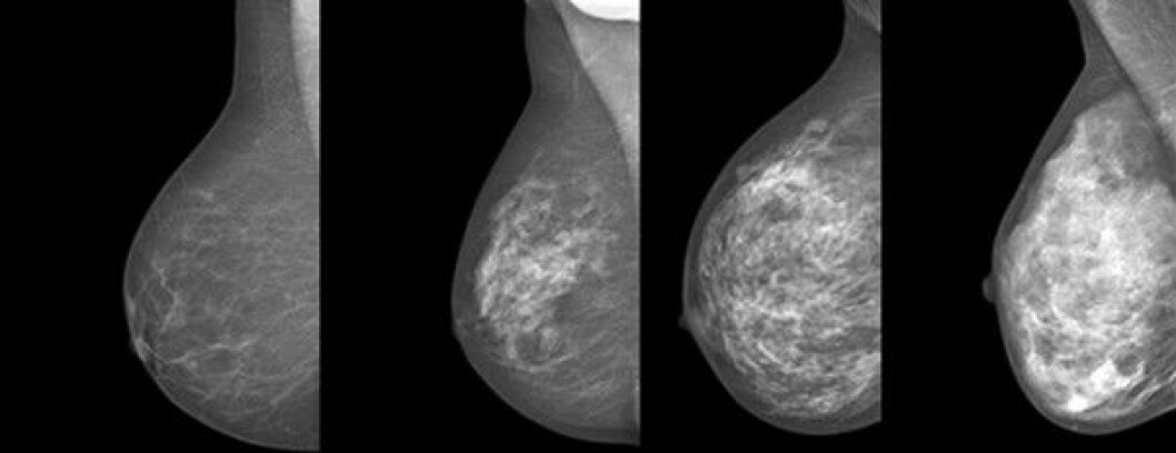 Mammografi – från vänster bröst med låg täthet och höger bröst med hög täthet Täta bröst olika typer