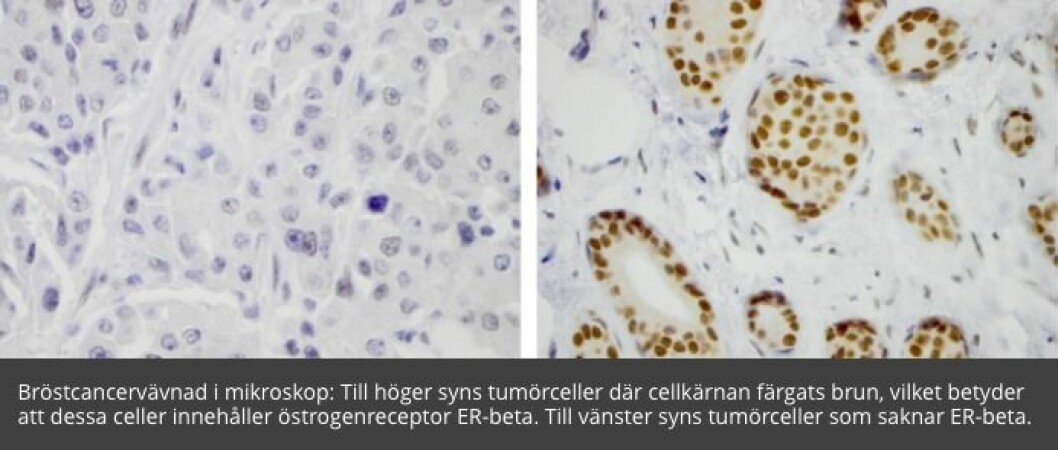 Foto: Cancerfonden Cancerceller