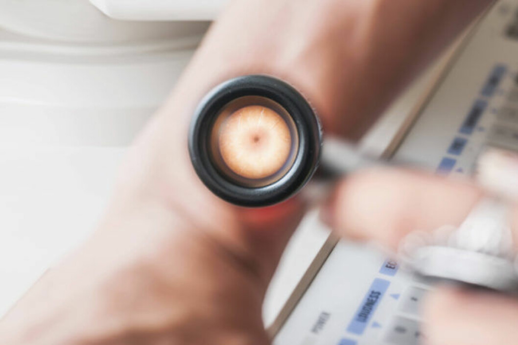 I dag undersöks misstänkta hudförändring med så kallat dermatoskop. Bild: IBL Bildbyrå Screening av hudcancer med så kallat dermatoskop.