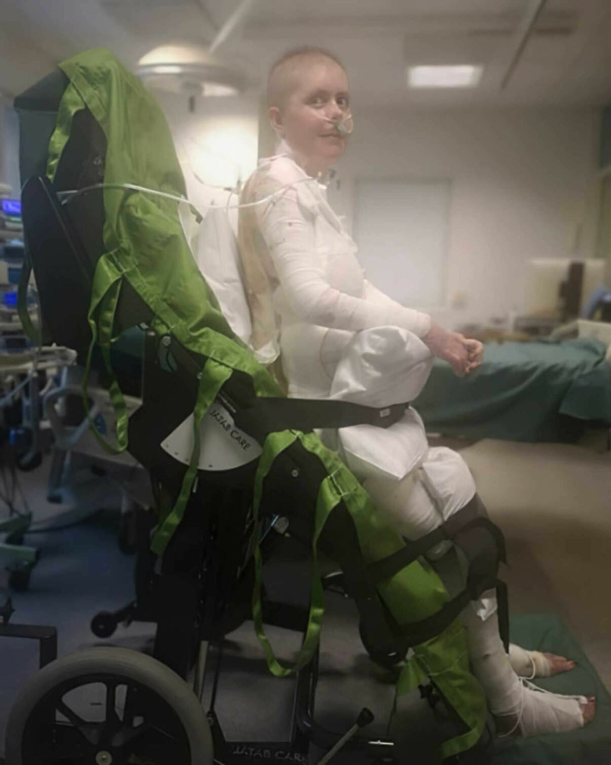 Emma Schols lever än i dag med svåra smärtor – men har trots allt återhämtat sig mirakulöst fort. Foto: Privat Emma Schols under rehabiliteringen