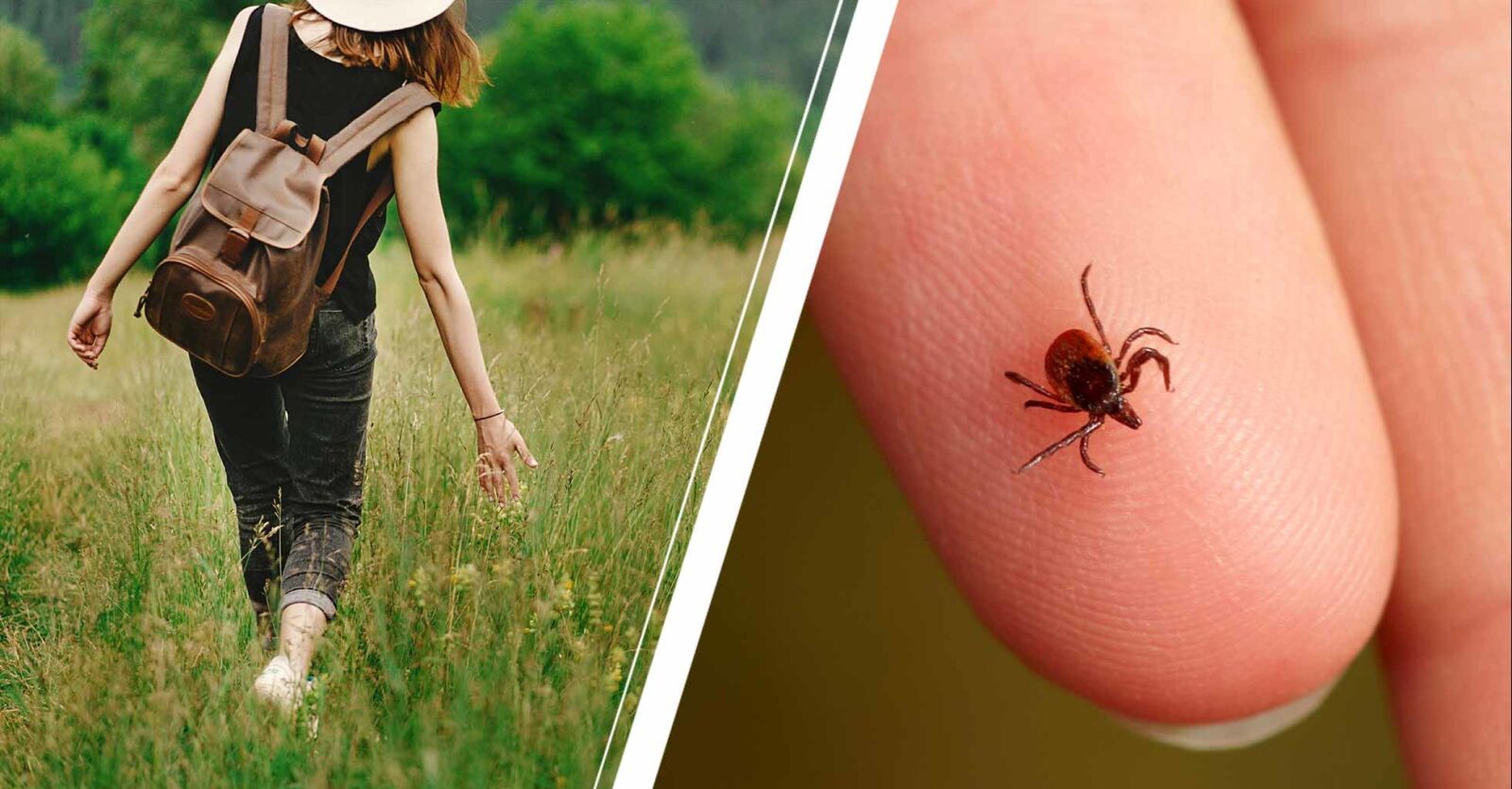 Fästing: Varför får en del fler fästingbett än andra? | MåBra