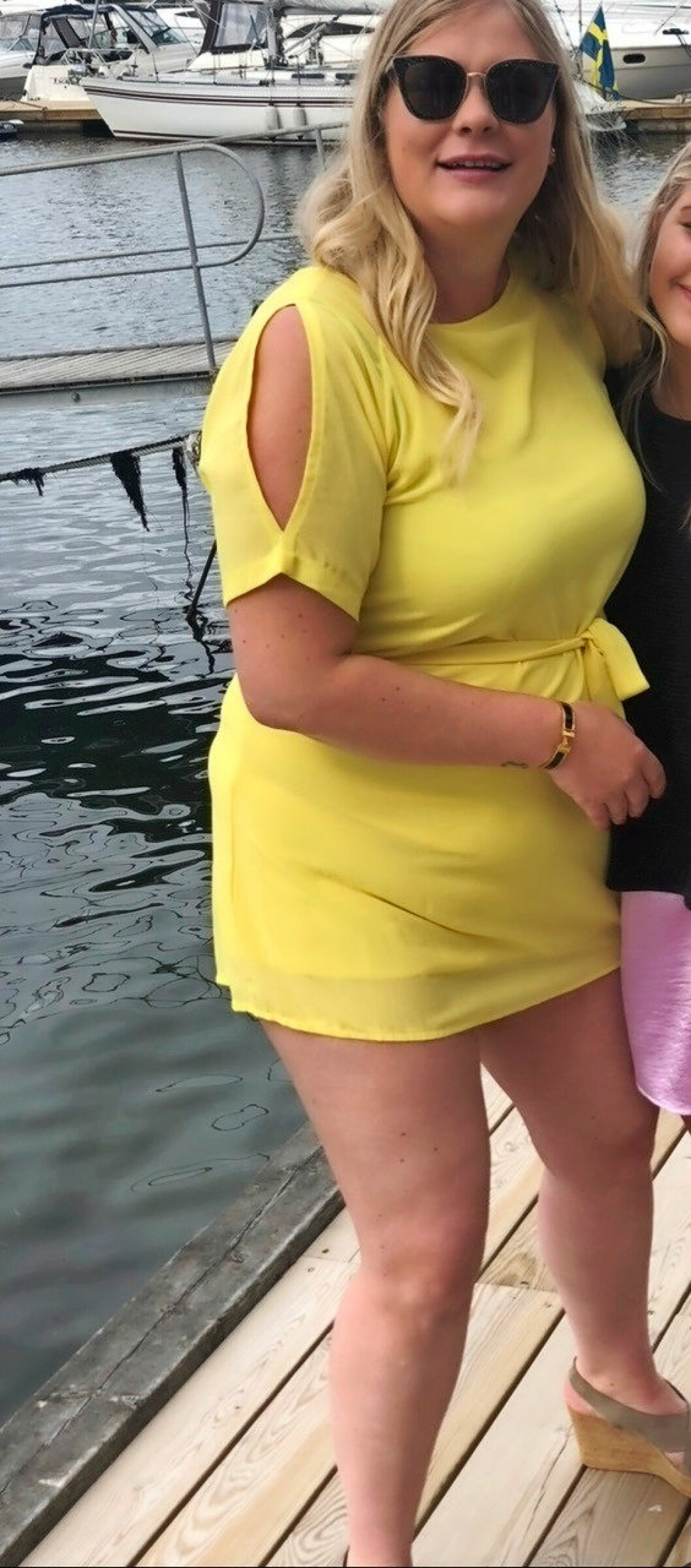 Petronella före ingreppet.