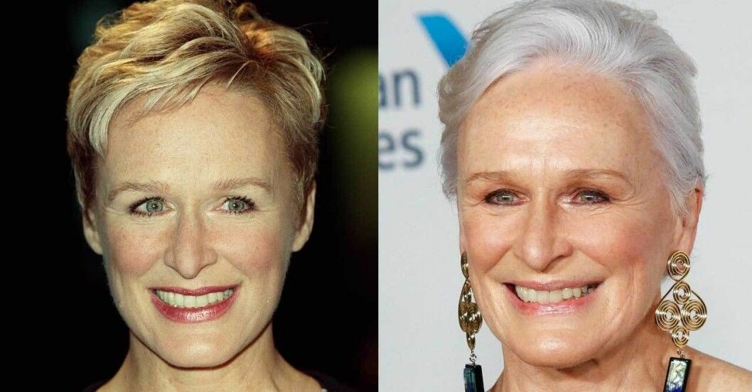 Glenn Close med färgat och grått hår