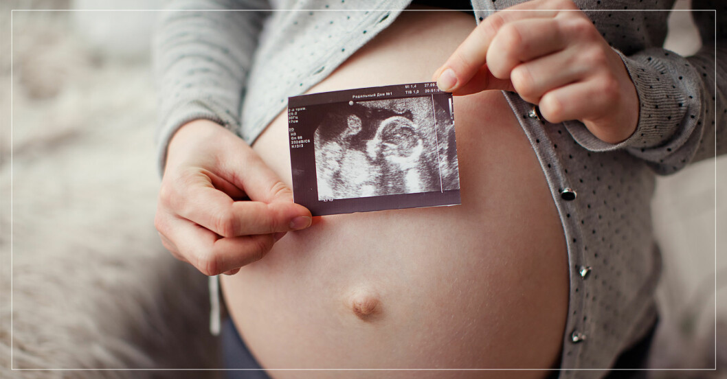 Gravid kvinna håller upp bild från ultraljud.