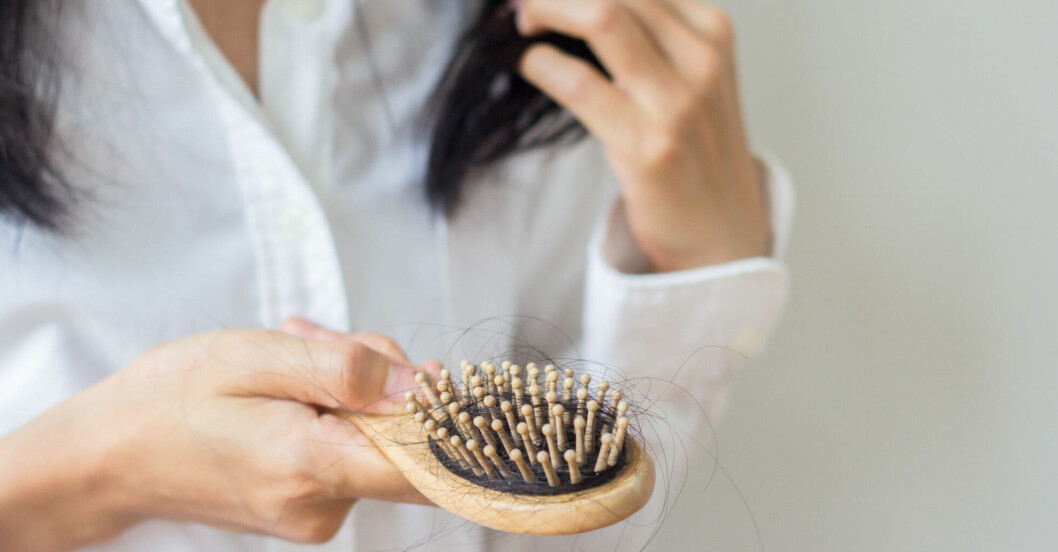 Kvinnligt håravfall kan behandlas