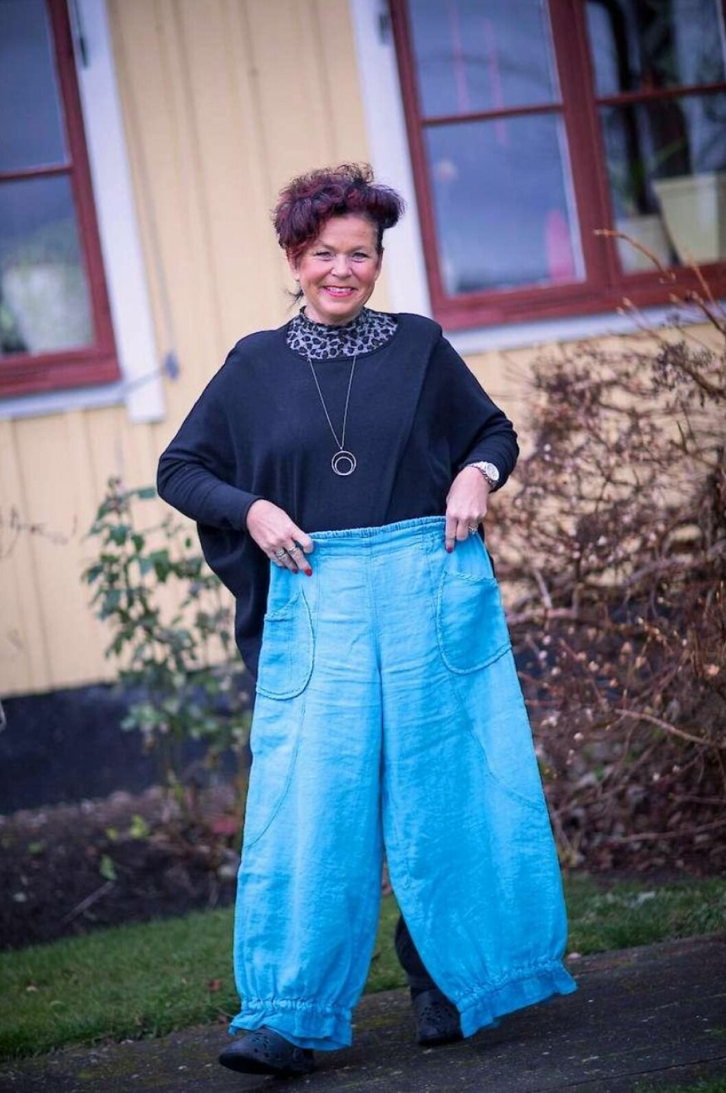 Nu har det gått drygt två år. Benet håller formen som det ska.