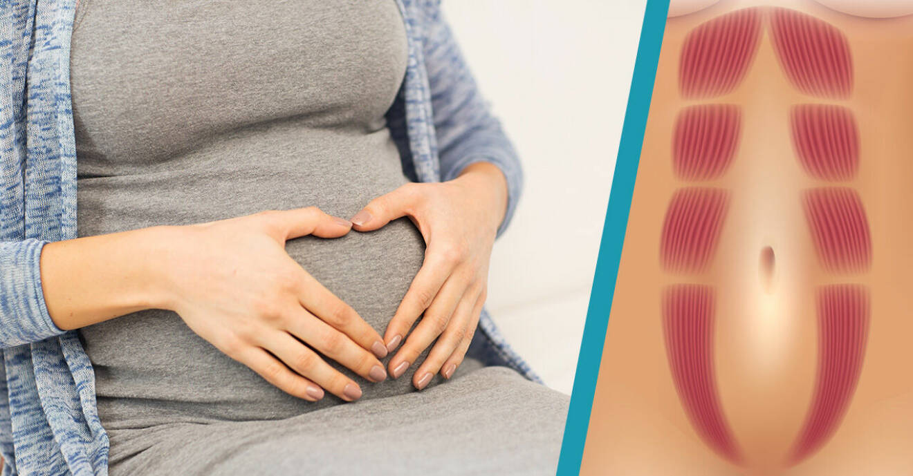 Gravid kvinna och illustration av delade magmuskler