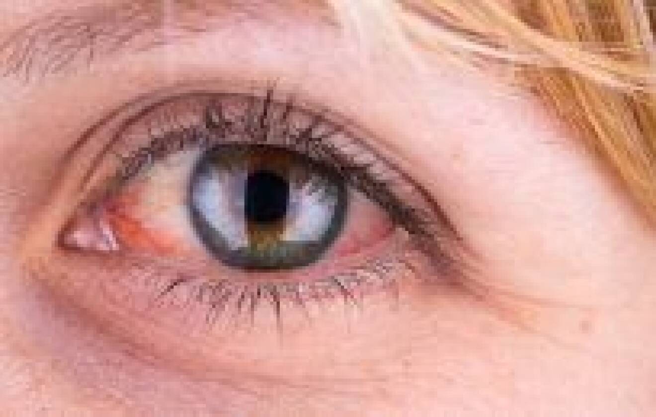 En kvinnas röda öga i närbild