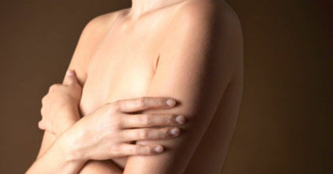 Färre kvinnor dör i bröstcancer, visar en ny studie.