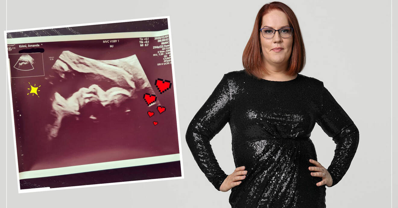 Amanda Krimi gick ner 60 kilo – nu är hon gravid