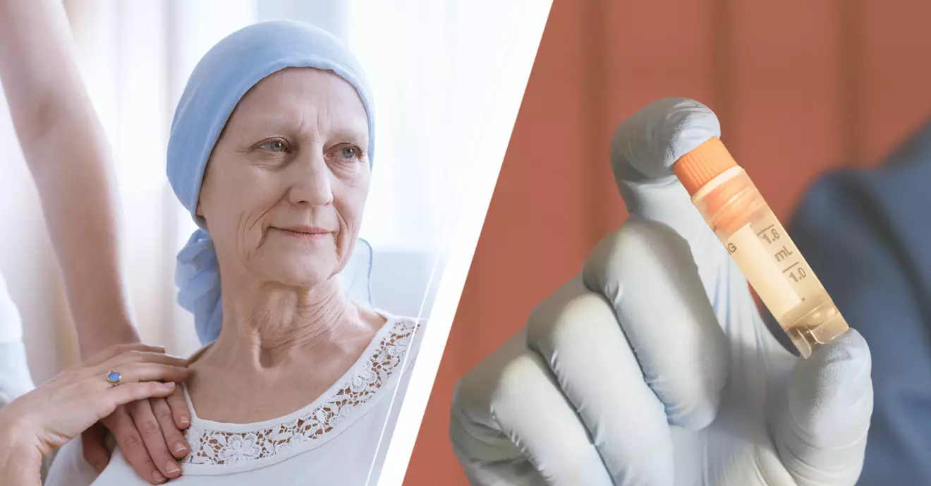 Äldre kvinna med cancer och en behållare innehållande stamceller.