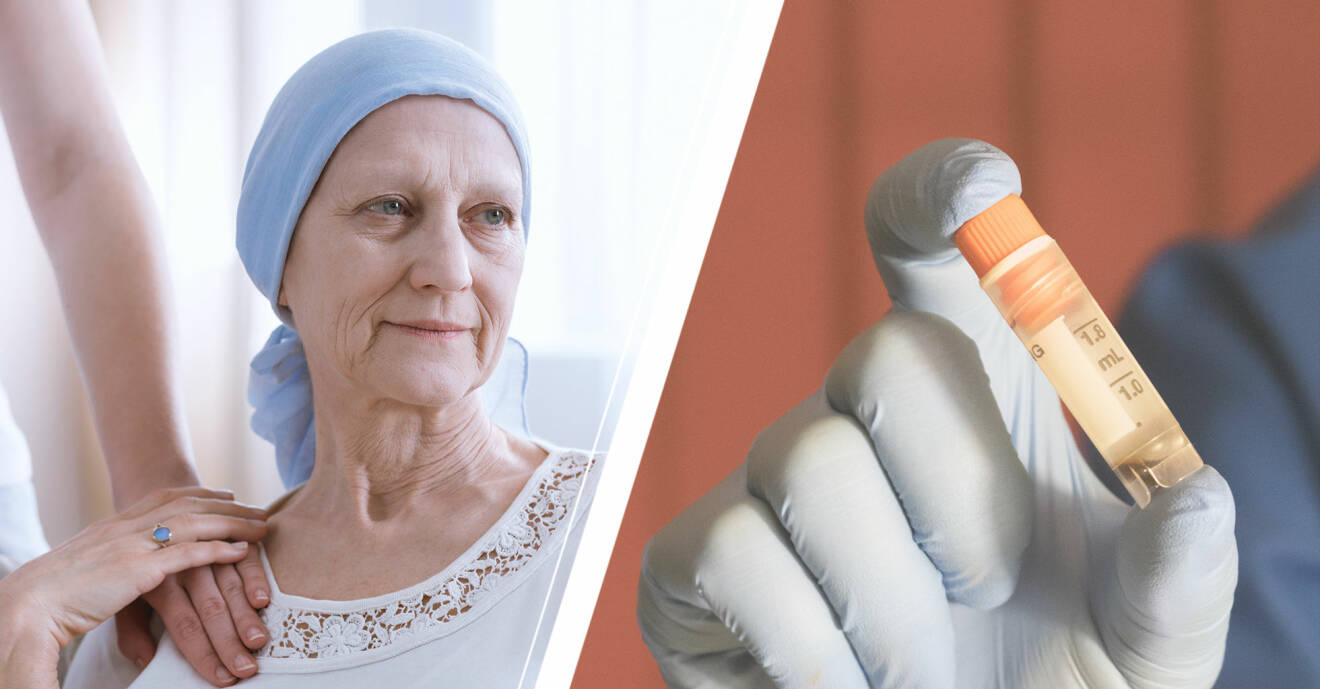 Äldre kvinna med cancer och en behållare innehållande stamceller.