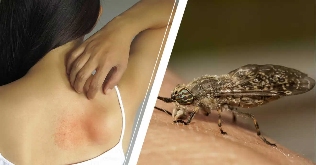 Kvinna som kliar på ett insektsbett och en broms som sitter på huden.