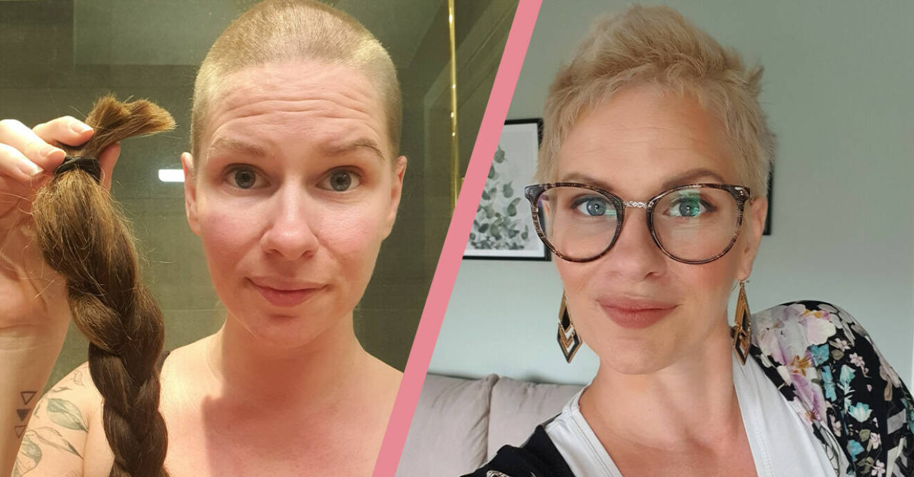 Sara Lagerquist när hon klippt av sitt hår efter första cancerbehandlingen