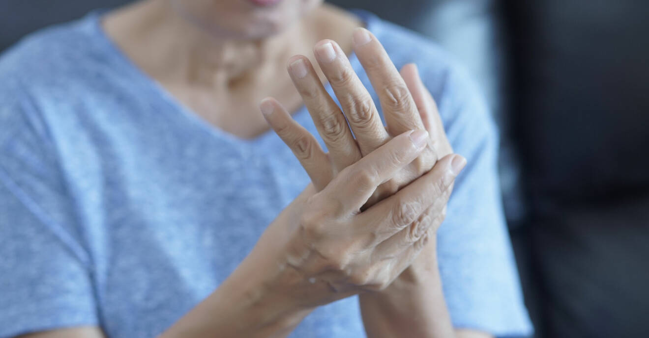 Kvinna med artros i händerna