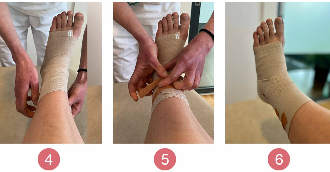 Bilder på hur du lindar en stukad fot