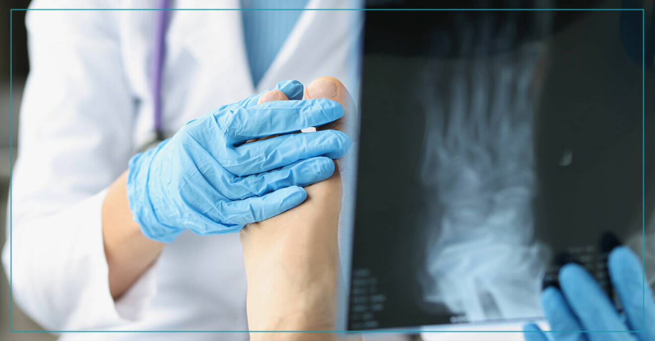 Läkare tittar på röntgenbild av en fot