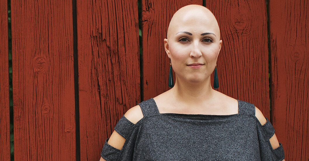 Lilian tappade allt sitt hår när hon fick alopecia. Nu accepterar hon sig själv.