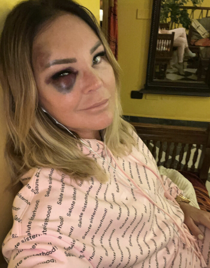 Magdalena Graaf blåtira