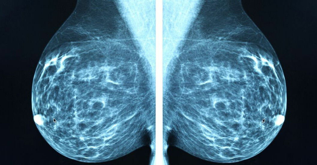 Mammografibild