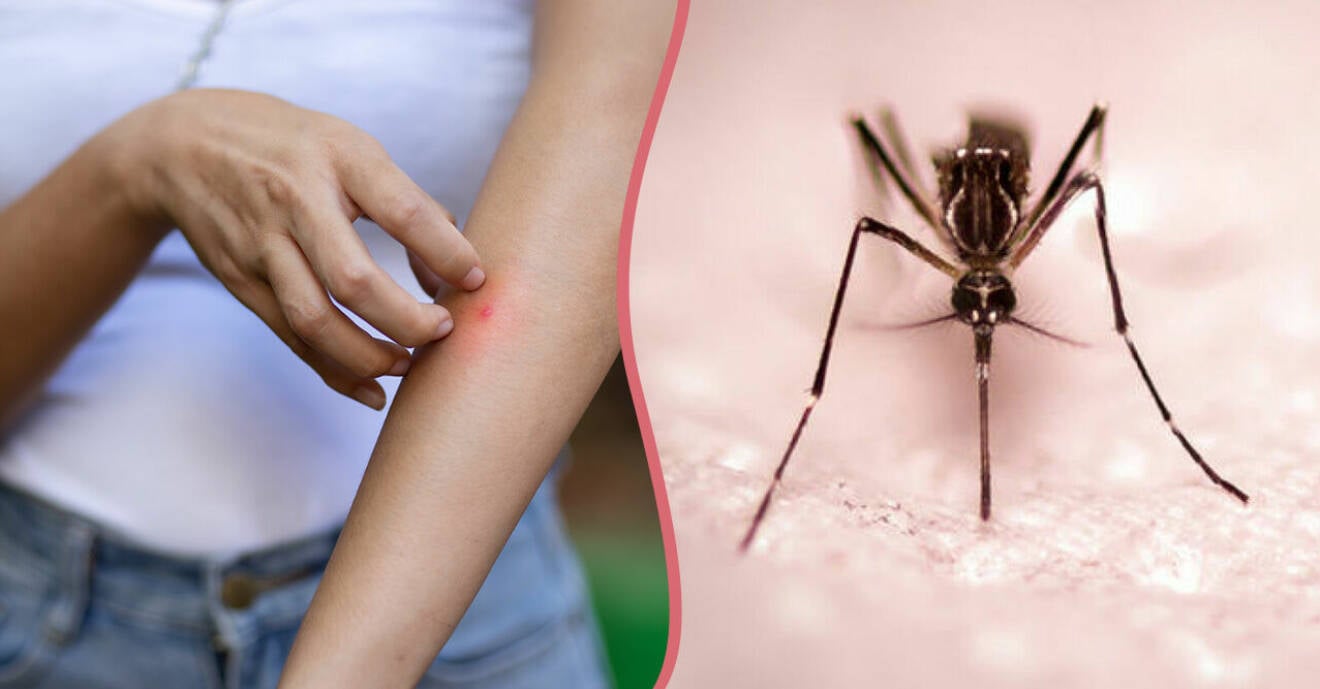 Splitbild: Kvinna kliar sig på armen och en mygga