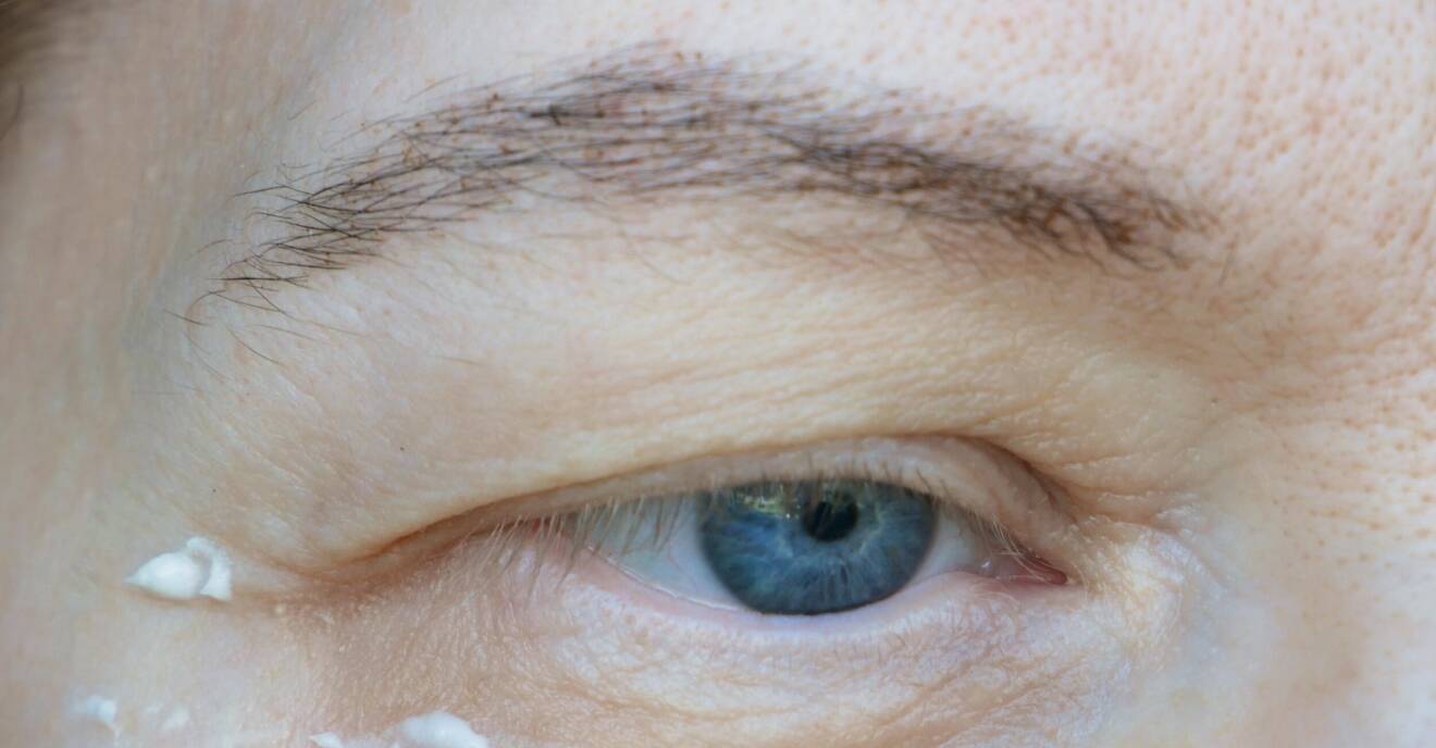 Närbild på öga med vit kräm under