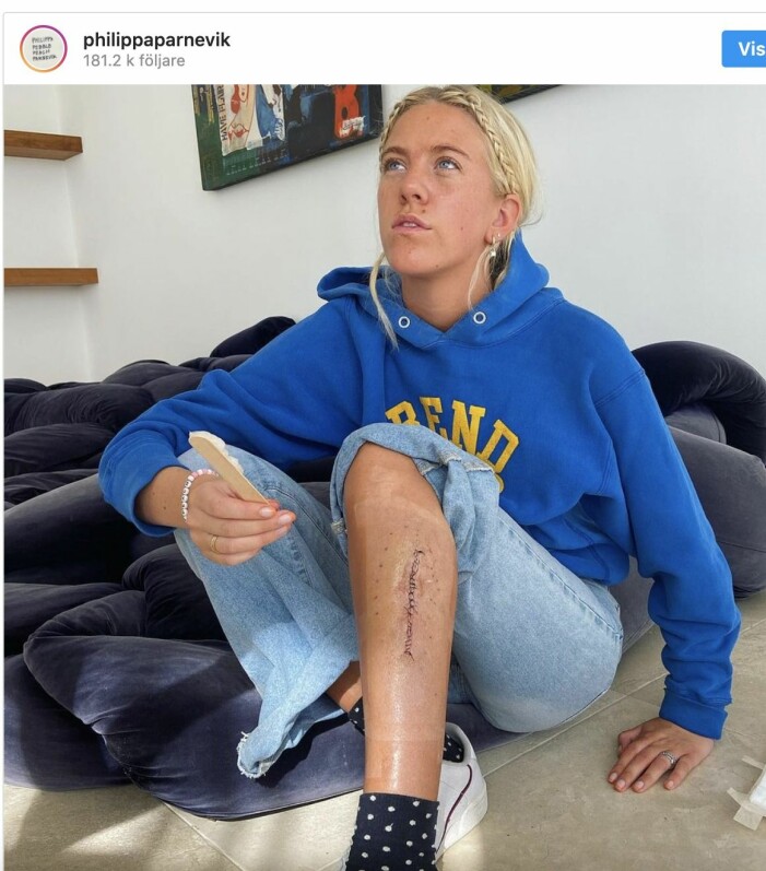 På sitt instagramkonto visar Philippa ärret efter canceroperationen. Philippa Parnevik bild på ärret