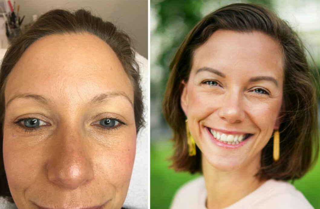 Annas ögonbryn, före och efter.
