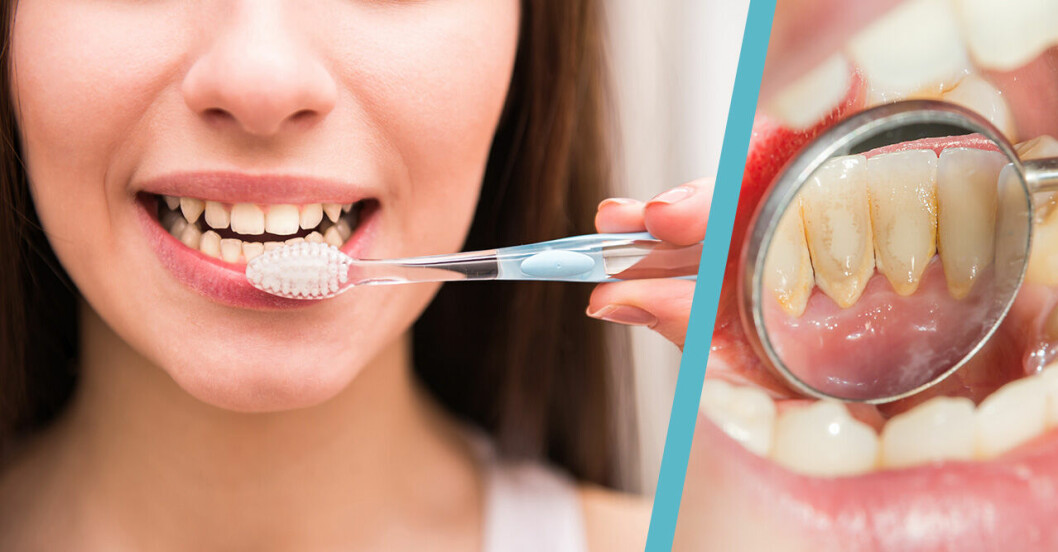 Kvinna som borstar tänderna och tänder med tandsten.