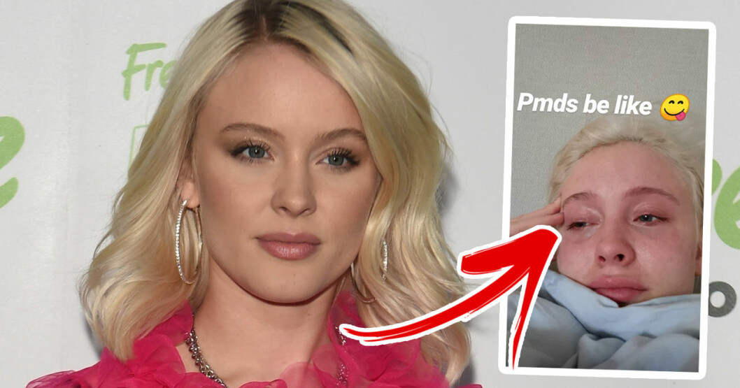 Zara Larsson la upp en bild på Instagram Stories på sig själv i tårar. Zara Larsson la upp en bild på Instagram Stories på sig själv i tårar.
